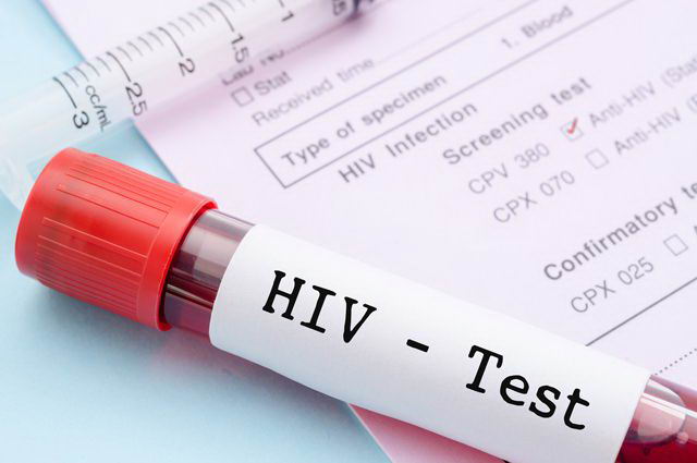 Сегодня во Львове можно сделать анонимный экспресс-тест на ВИЧ