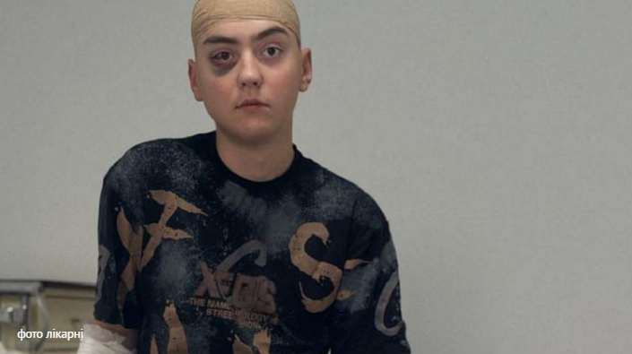 Нейрохірурги Львова успішно видалили рідкісну пухлину мозку 17-річному підлітку з Вінниці