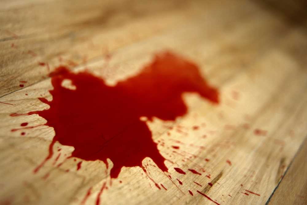 На Львівщині чоловік напав з ножем на молодшого брата