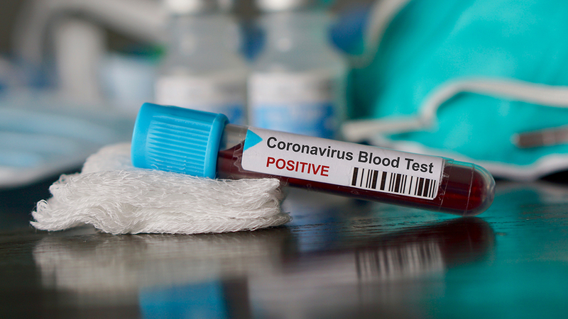 За добу на Львівщині - 45 позитивних ПЛР-тестів, загалом 1405 інфікованих коронавірусом