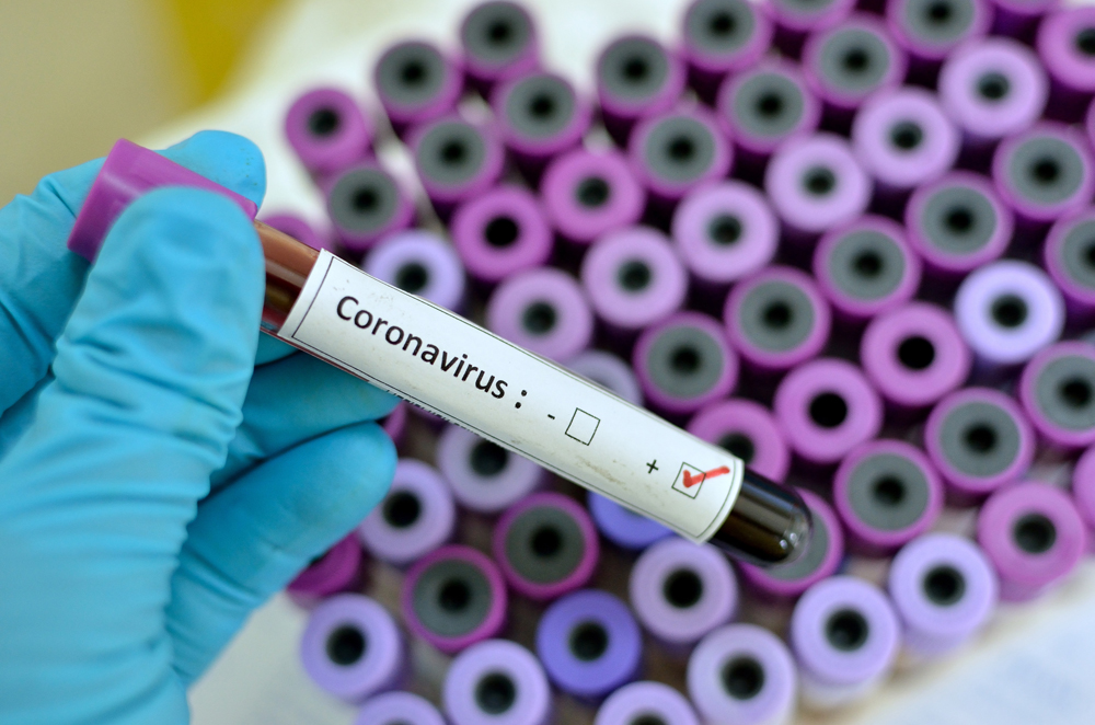 На Львівщині - ще 85 позитивних ПЛР-тестів, загалом - 1915 інфікованих коронавірусом